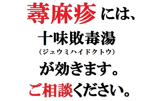 90％OFF】 十味敗毒湯 じゅうみはいどくとう エキス錠 240錠 約20日分 X 5個 急性皮膚疾患の初期 じんましん 湿疹 皮膚炎 水虫  化膿性皮膚疾患 漢方薬 P10 fucoa.cl